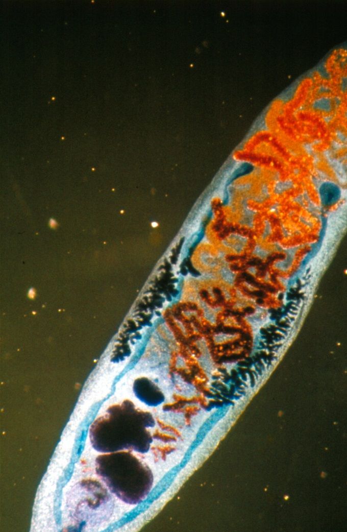Dicrocoelium sp: een leverbot bij schapen, runderen en andere herkauwers.(gekleurd)