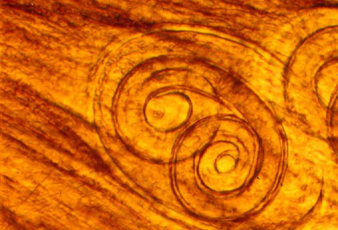De mens heeft iets van een ingekapselde larve van de 'spierworm' (Trichinella spiralis) , die jarenlang in een slaaptoestand blijft leven. Met eindeloos geduld wacht ze op het zoogdier dat het rauwe vlees verorbert waarin ze verborgen zit om uiteindelijk tot leven te komen. Kunnen religies de 'slapende mens' helpen in zijn ontwakingsproces?