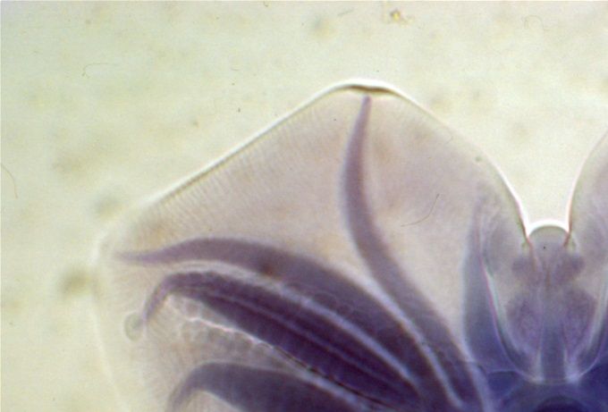 Staart van de Rode Maagworm (Hyostrongylus rubidus)