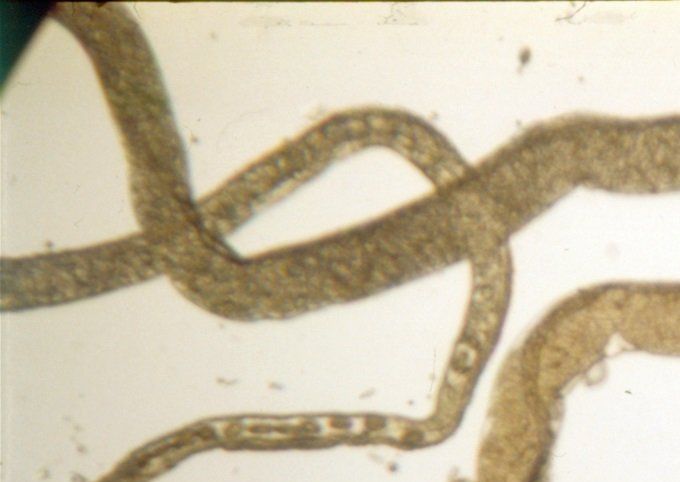 Door op de vrouwelijke worm (Trichosomoides crasicauda)  te drukken wordt het mannetje uit de vulva geperst. Ook de eieren komen mee naar buiten.