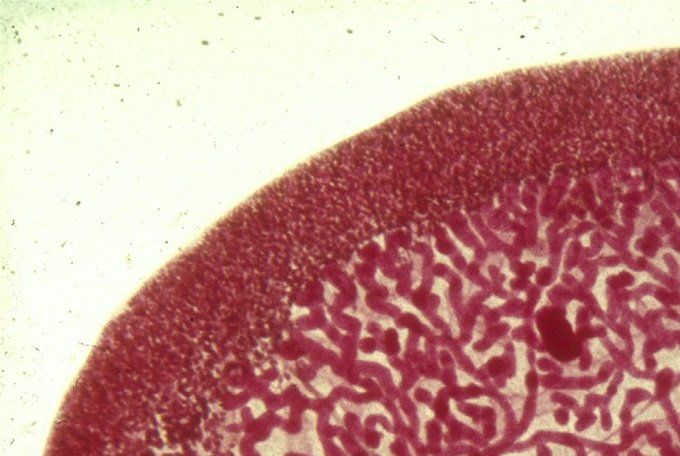 De leverbot (Fasciola hepatica)  is tweeslachtig. Volwassen leverbot (gekleurd) met duidelijk zichtbare zuignappen